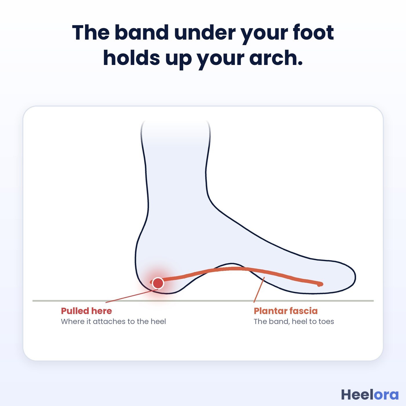 The band under your foot holds up your arch