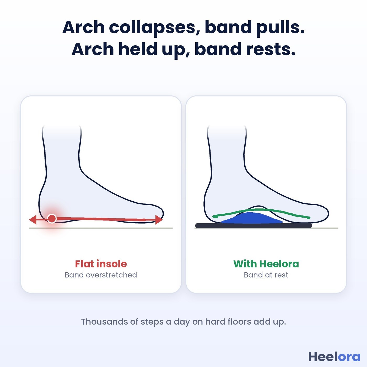 Arch collapses and the band pulls; arch held up and the band rests
